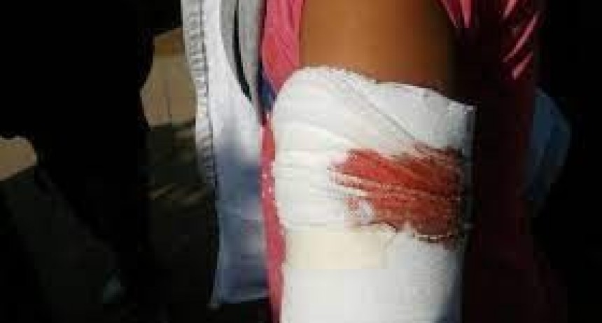 Le pegaron un tiro en el brazo