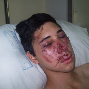 Brutal paliza a un joven en la zona del puerto