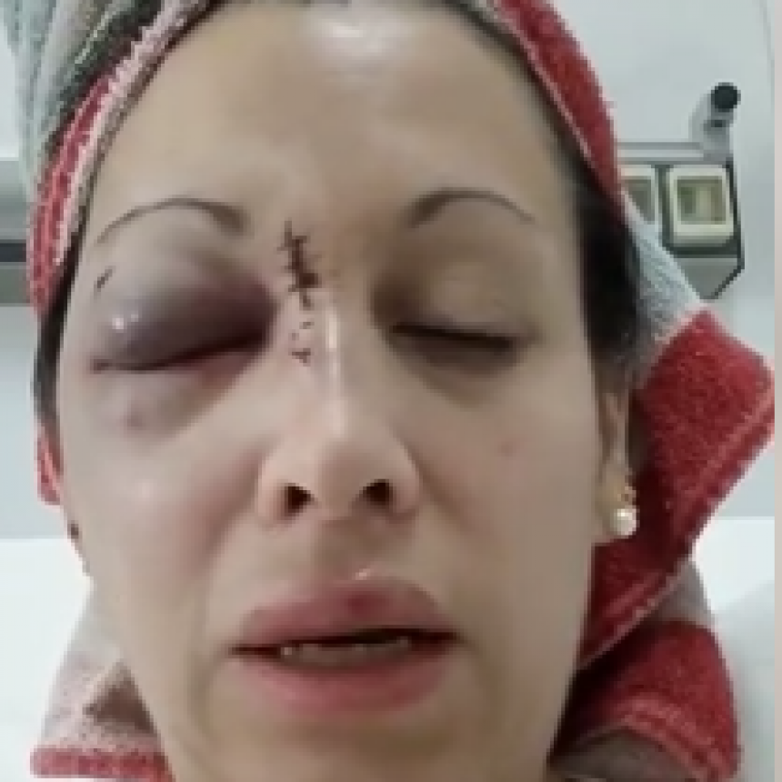 Brutal ataque a una mujer