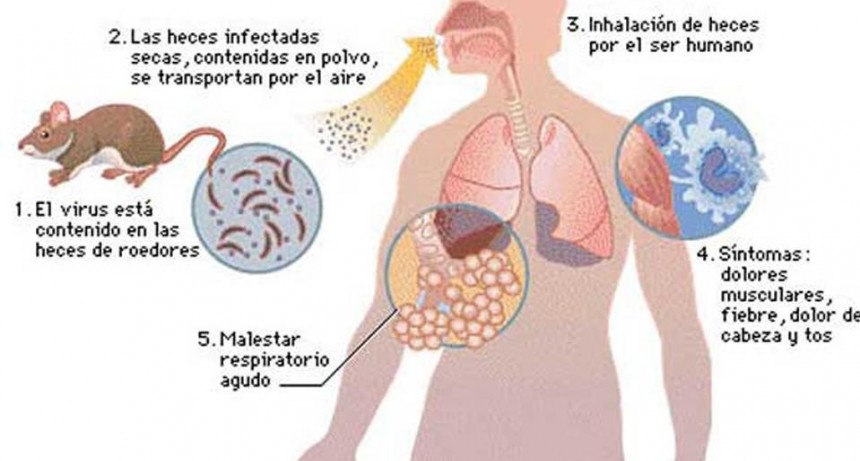 Confirman que se trata de un caso de Hantavirus