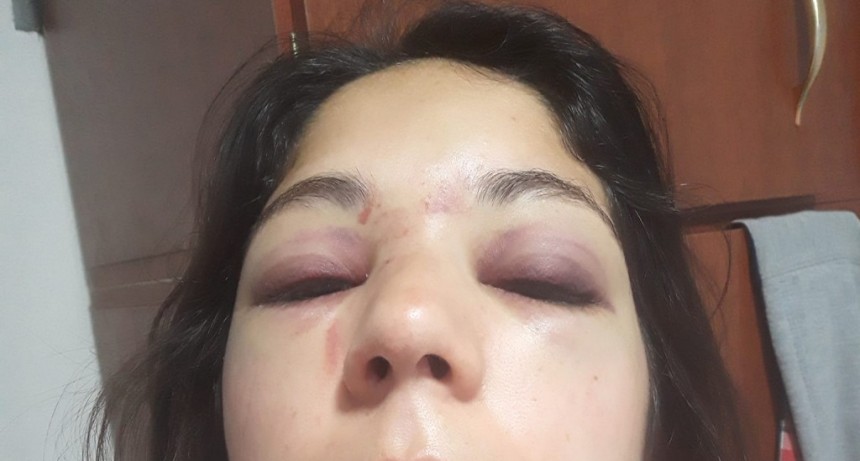 Una joven denunció que fue brutalmente golpeada