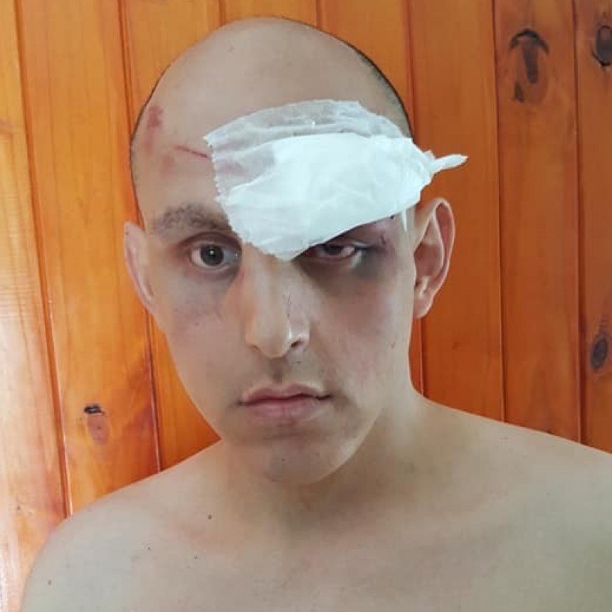 Repudio - La homofobia mata